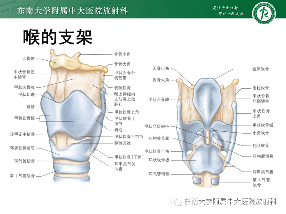 影像PPT - 【PPT】喉癌-6