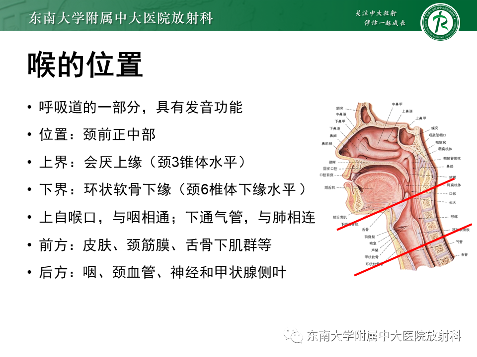 影像PPT - 【PPT】喉癌-4