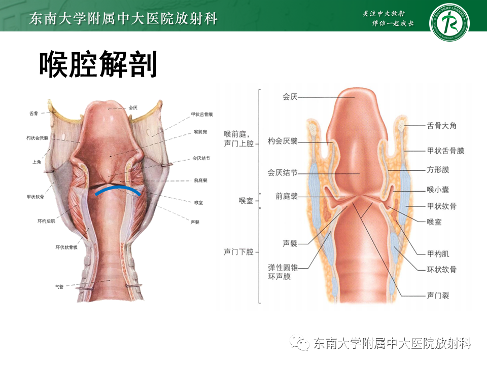 影像PPT - 【PPT】喉癌-8