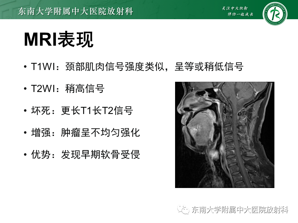 影像PPT - 【PPT】喉癌-24