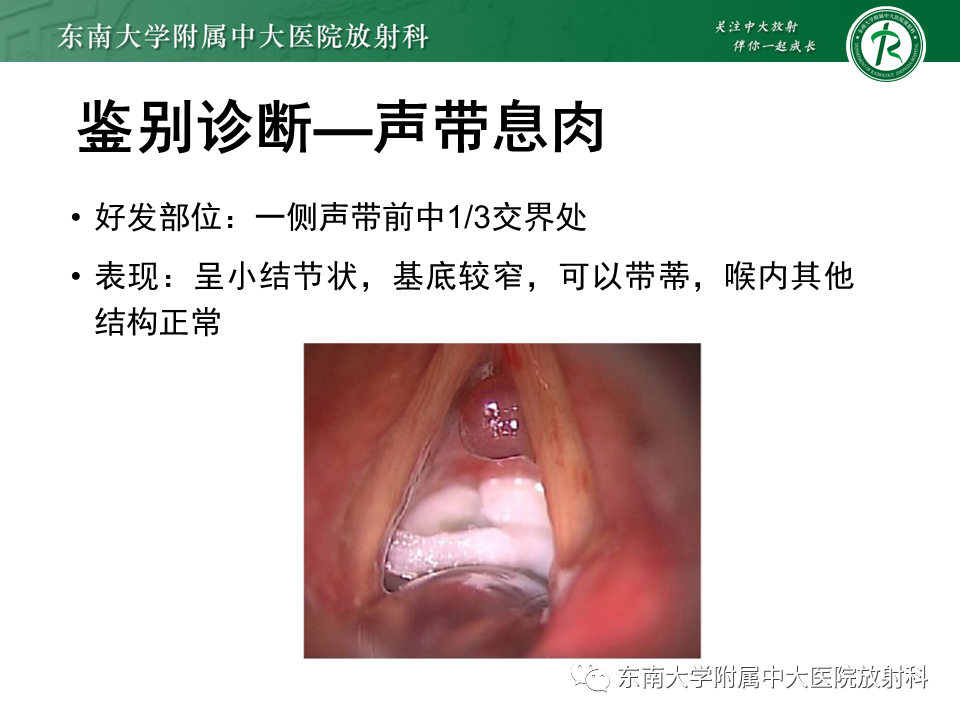 影像PPT - 【PPT】喉癌-29