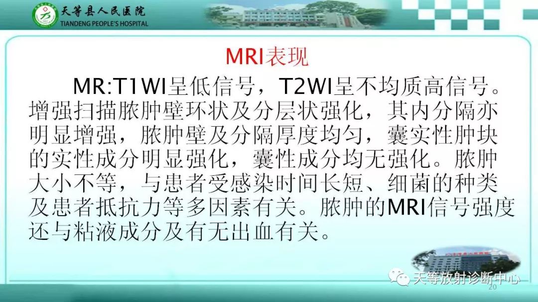 影像PPT - 【PPT】输卵管卵巢脓肿CT、MRI诊断及鉴别诊断-20 影像PPT - 【PPT】输卵管卵巢脓肿CT、MRI诊断及鉴别诊断-20