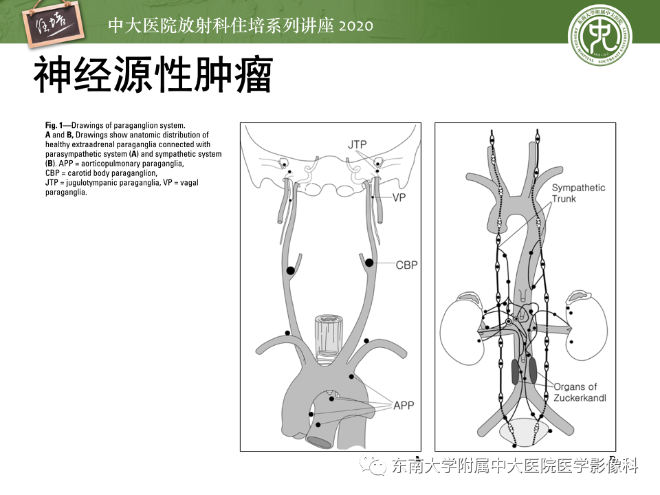 影像PPT - 【PPT】头颈部神经源性肿瘤的影像诊断-3