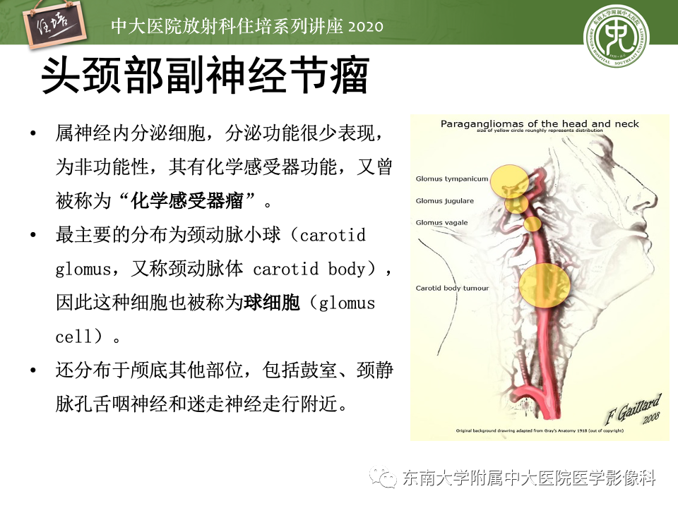 影像PPT - 【PPT】头颈部神经源性肿瘤的影像诊断-4