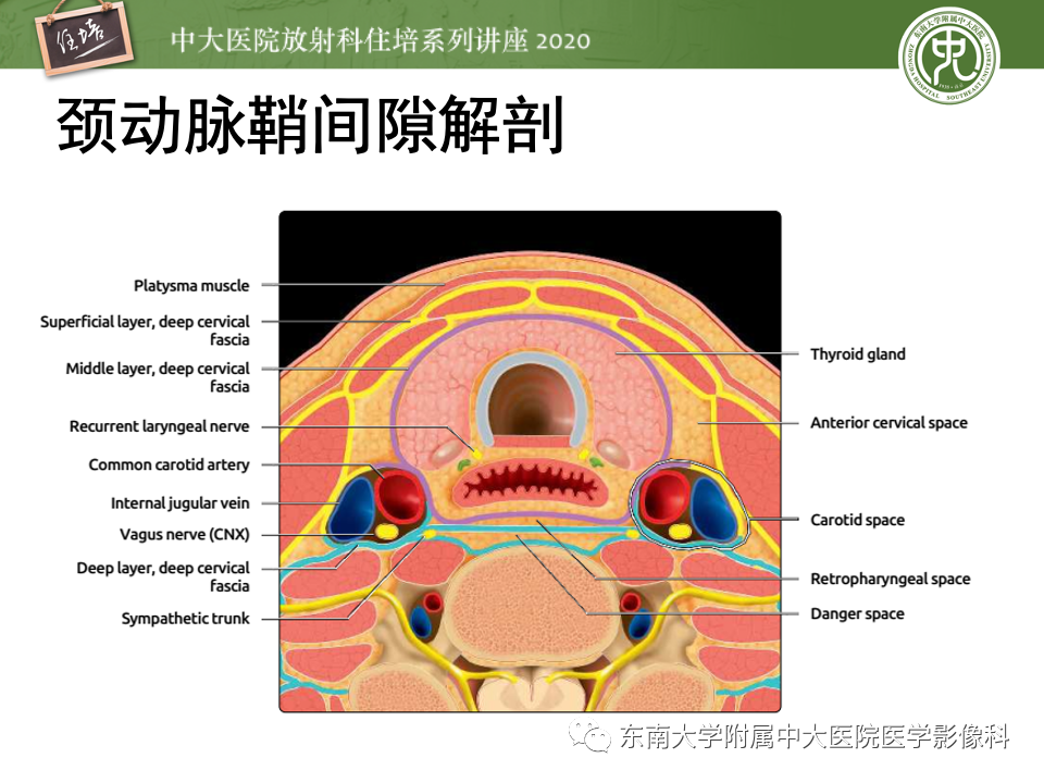 影像PPT - 【PPT】头颈部神经源性肿瘤的影像诊断-21