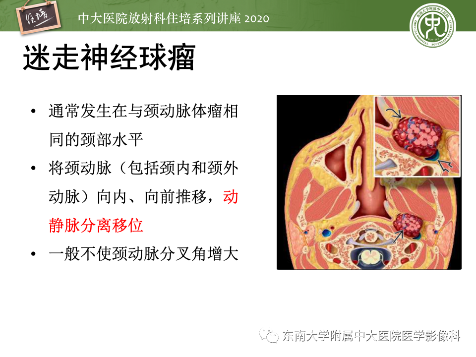 影像PPT - 【PPT】头颈部神经源性肿瘤的影像诊断-28