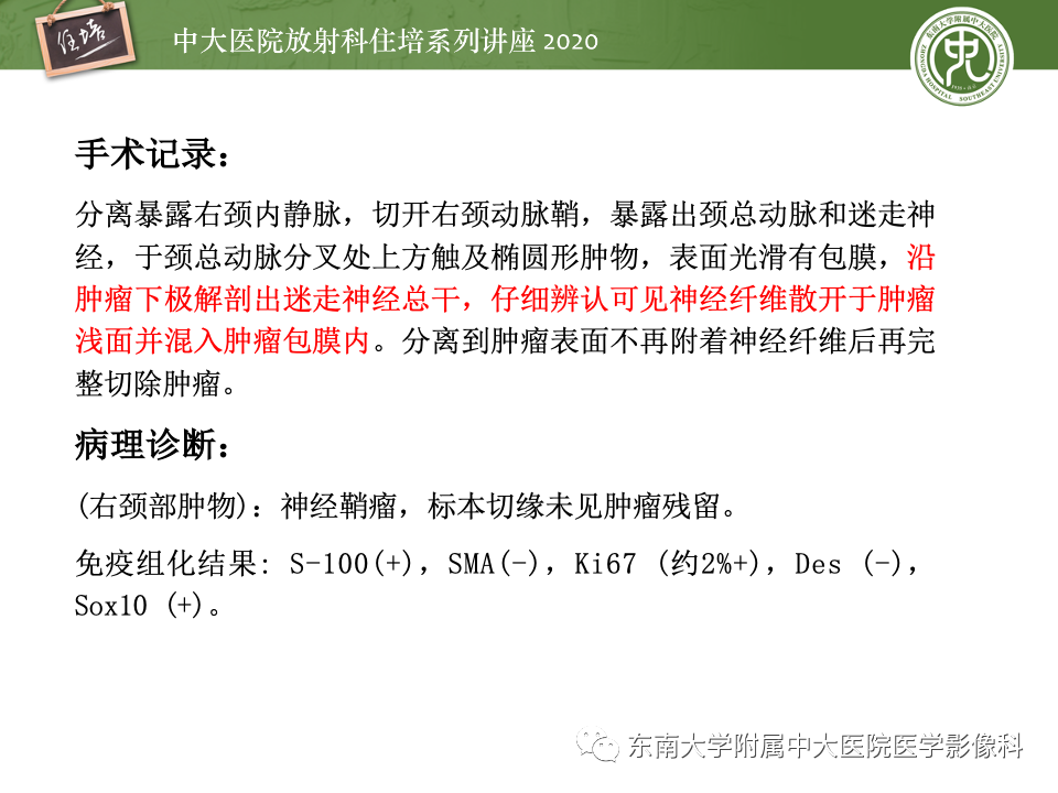 影像PPT - 【PPT】头颈部神经源性肿瘤的影像诊断-32