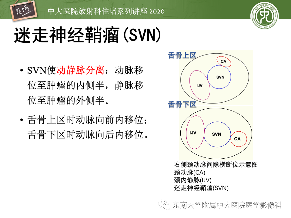 影像PPT - 【PPT】头颈部神经源性肿瘤的影像诊断-35