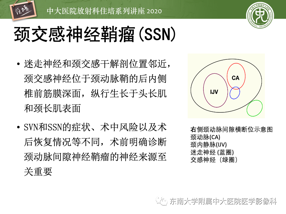影像PPT - 【PPT】头颈部神经源性肿瘤的影像诊断-38