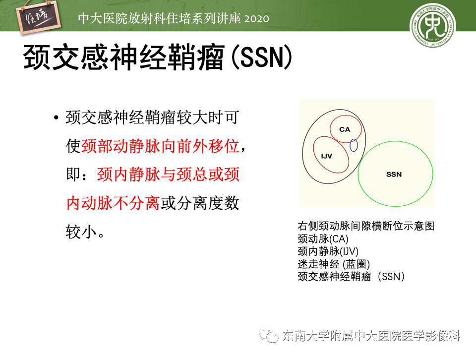 影像PPT - 【PPT】头颈部神经源性肿瘤的影像诊断-39