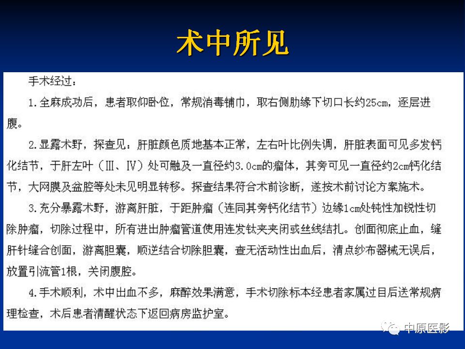 影像PPT - 【PPT】肝脏上皮样血管内皮瘤影像表现-8