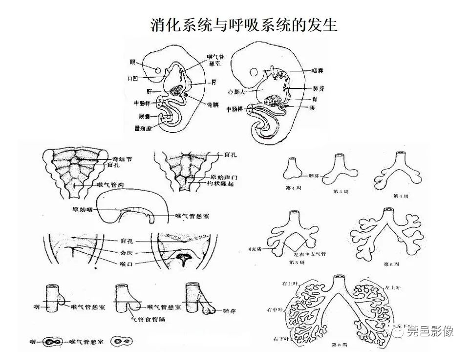 影像PPT - 【PPT】胃重复畸形-7 影像PPT - 【PPT】胃重复畸形-7