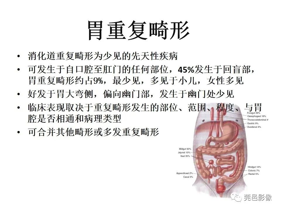 影像PPT - 【PPT】胃重复畸形-9 影像PPT - 【PPT】胃重复畸形-9