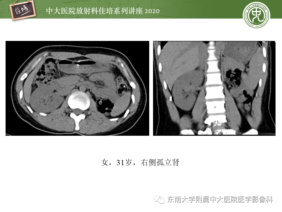 影像PPT - 【PPT】泌尿系统先天发育异常的影像表现-5