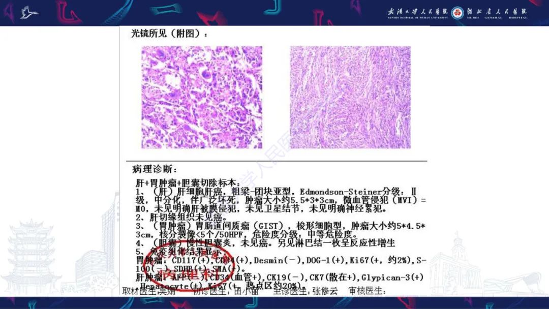 影像PPT - 【PPT】肝脏多房囊性病变影像诊断-11