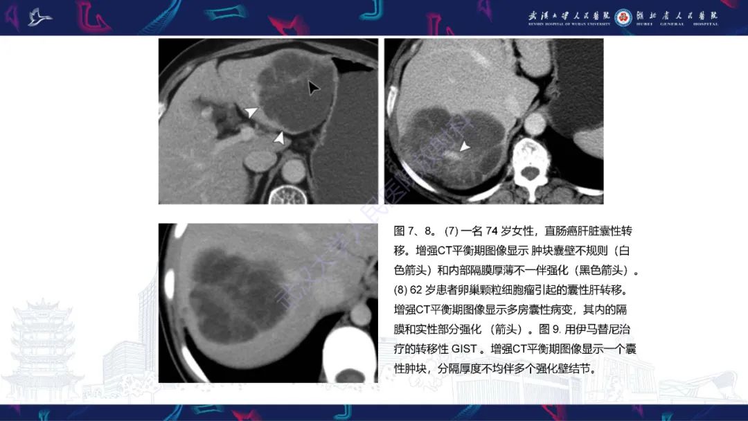 影像PPT - 【PPT】肝脏多房囊性病变影像诊断-16
