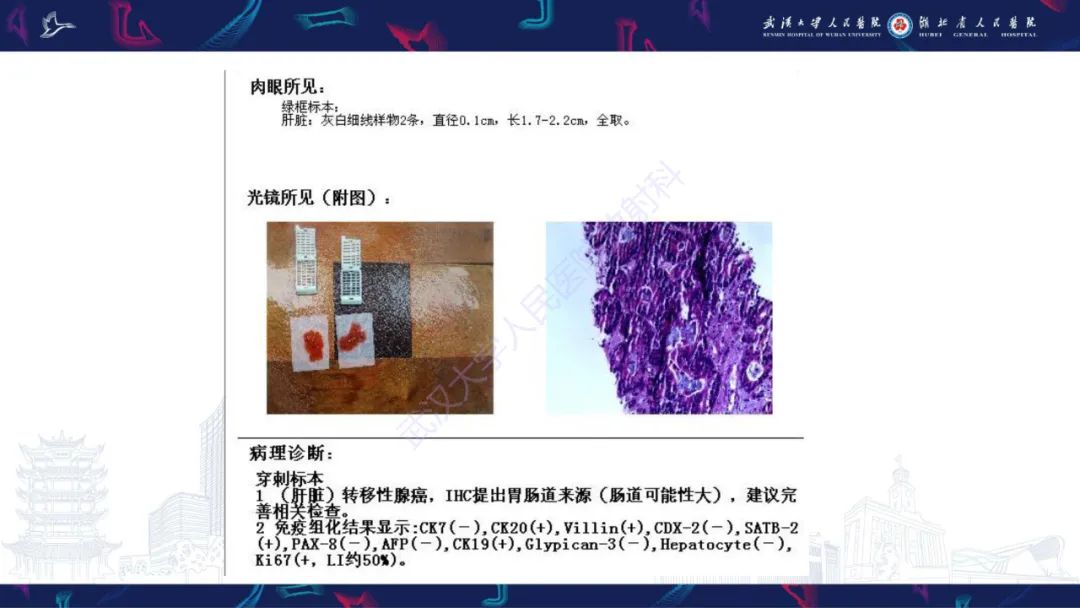 影像PPT - 【PPT】肝脏多房囊性病变影像诊断-18