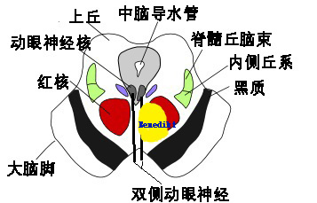 影像PPT - 10大常见脑干综合征-5 影像PPT - 10大常见脑干综合征-5