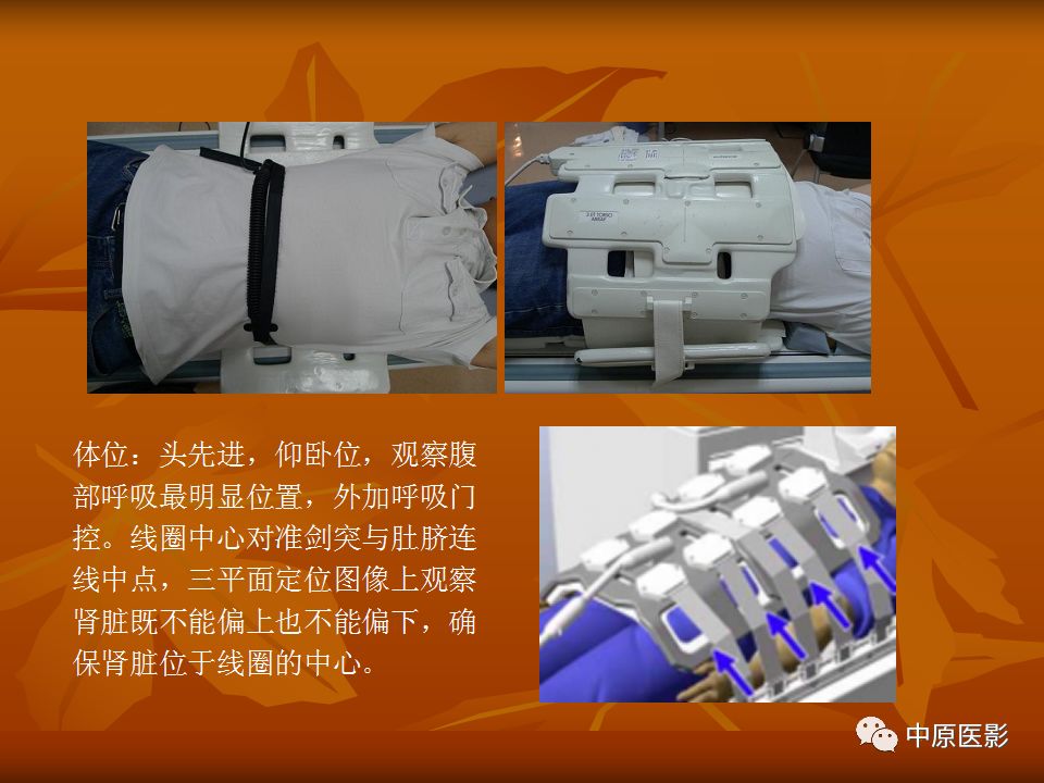 影像PPT - 【PPT】常规MRI检查在肾脏疾病中的应用-3