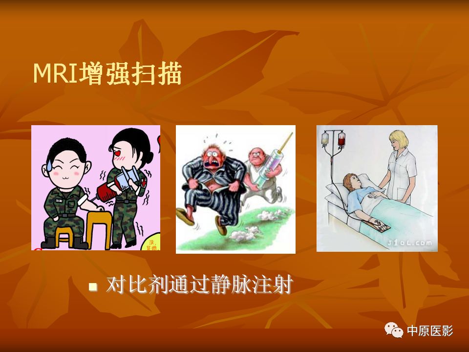 影像PPT - 【PPT】常规MRI检查在肾脏疾病中的应用-58