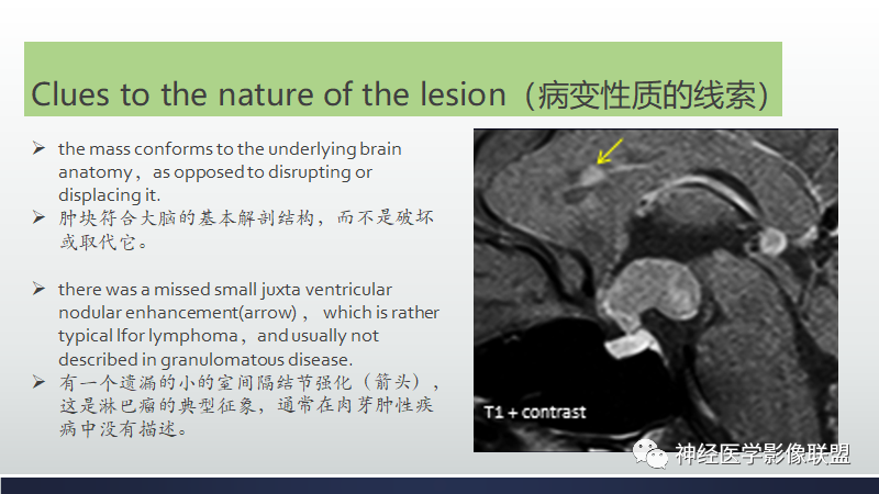 影像PPT - 【PPT】脑肿瘤和肿瘤样病变中的遗漏、误解和误导性影像征象-12