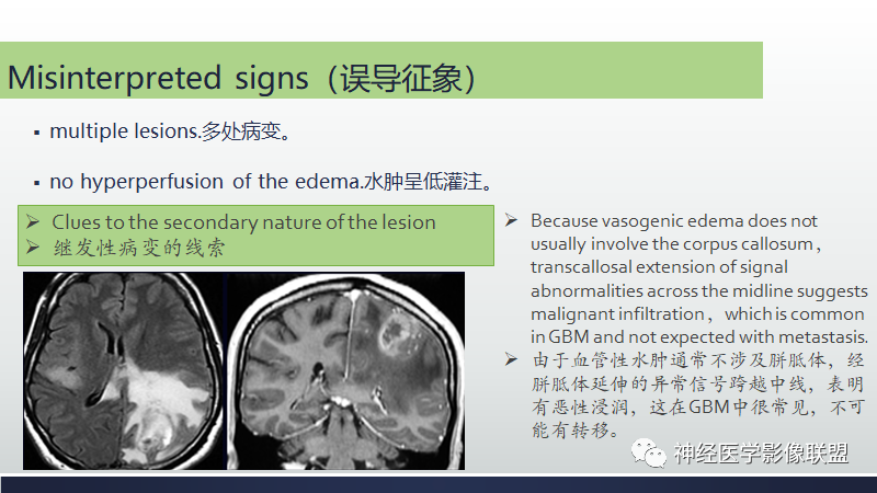 影像PPT - 【PPT】脑肿瘤和肿瘤样病变中的遗漏、误解和误导性影像征象-29