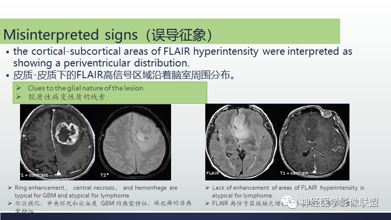 影像PPT - 【PPT】脑肿瘤和肿瘤样病变中的遗漏、误解和误导性影像征象-33