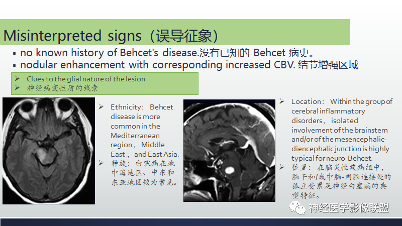 影像PPT - 【PPT】脑肿瘤和肿瘤样病变中的遗漏、误解和误导性影像征象-36
