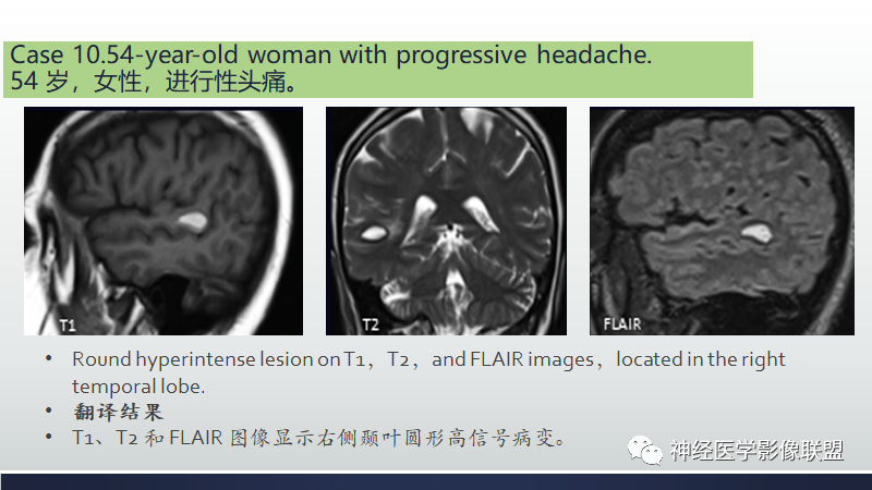 影像PPT - 【PPT】脑肿瘤和肿瘤样病变中的遗漏、误解和误导性影像征象-38