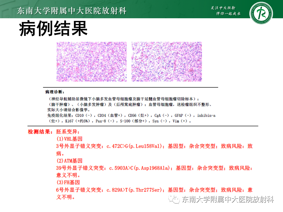 影像PPT - 【PPT】VHL综合征-3