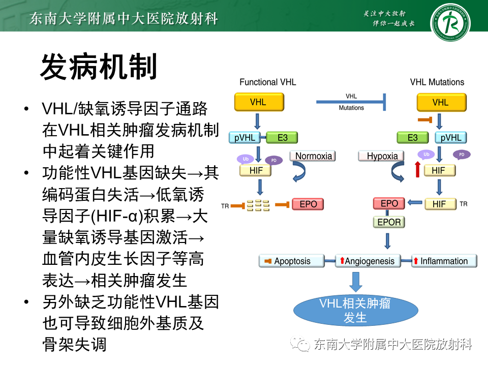 影像PPT - 【PPT】VHL综合征-6