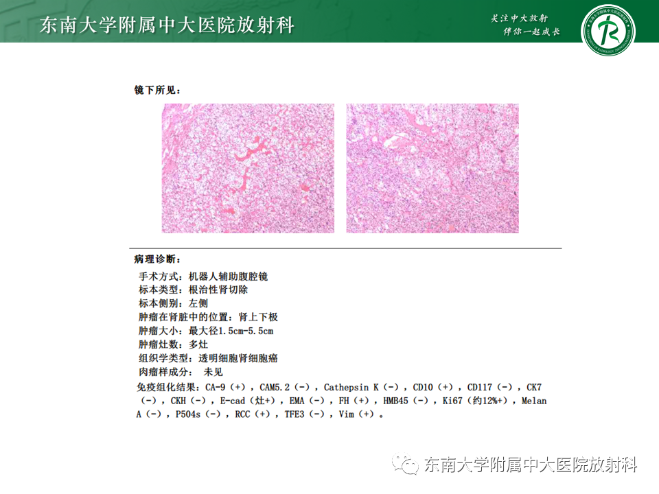 影像PPT - 【PPT】VHL综合征-23