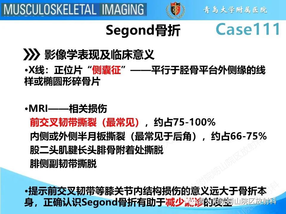 影像PPT - 【PPT】Segond 骨折-8