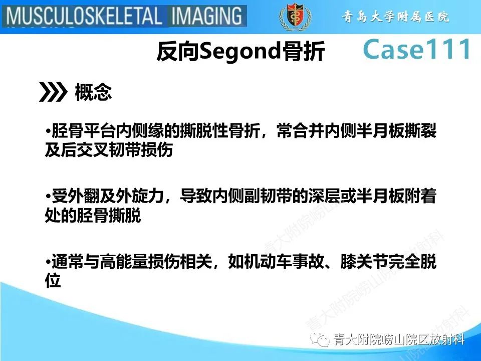 影像PPT - 【PPT】Segond 骨折-12
