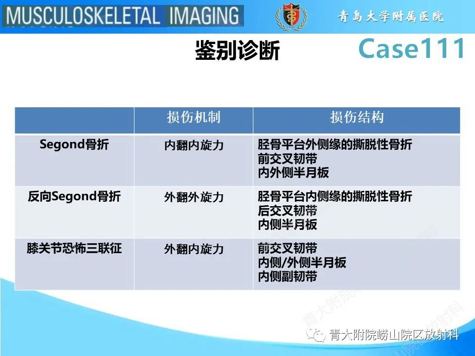 影像PPT - 【PPT】Segond 骨折-24