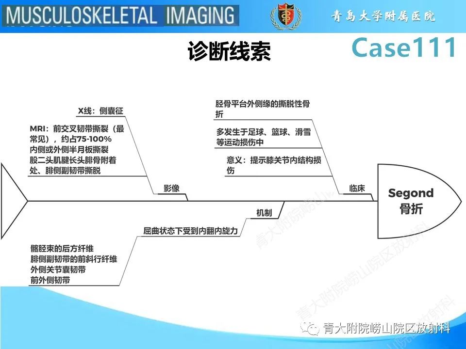 影像PPT - 【PPT】Segond 骨折-31