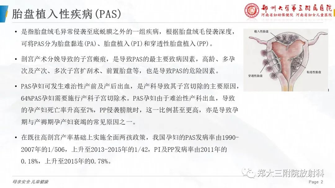 影像PPT - 要点解读-2