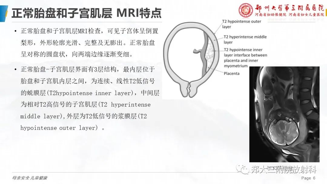 影像PPT - 要点解读-6