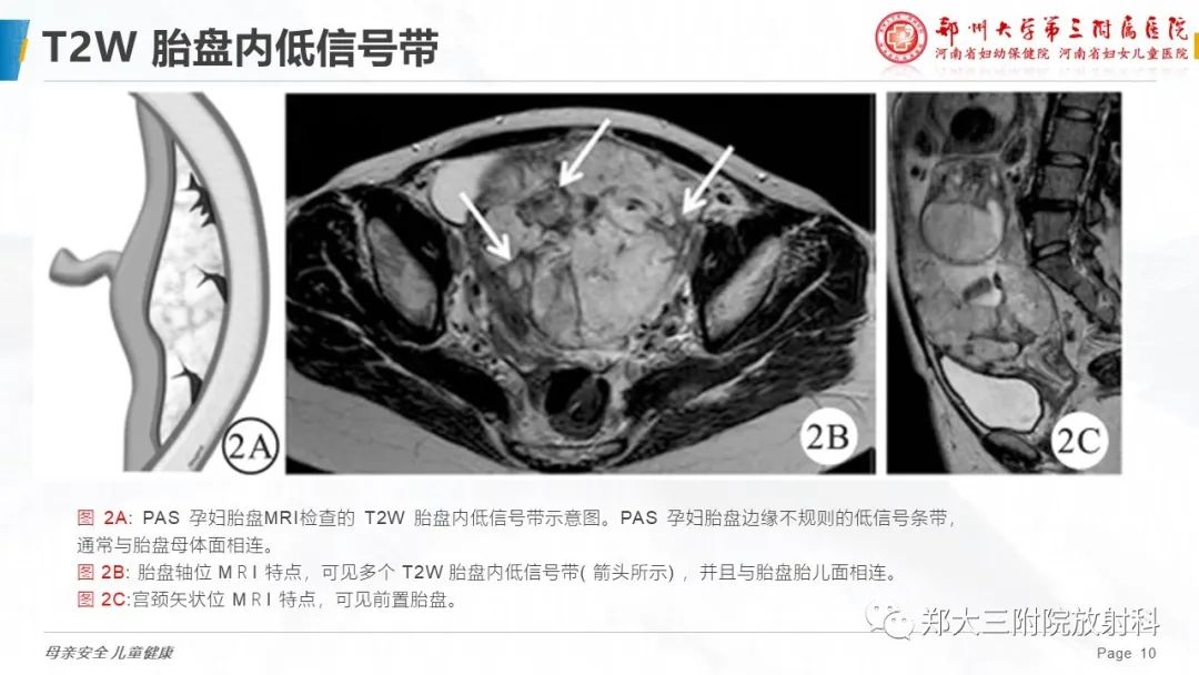 影像PPT - 要点解读-10