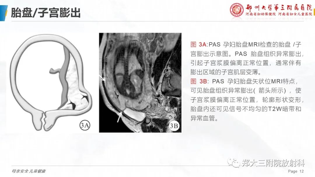 影像PPT - 要点解读-12