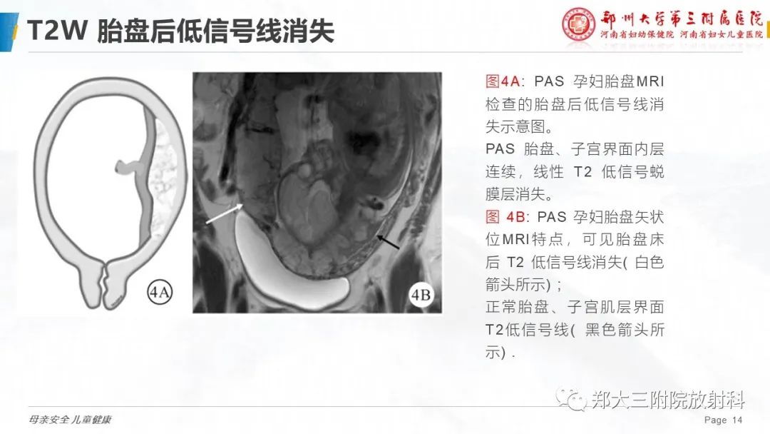 影像PPT - 要点解读-14