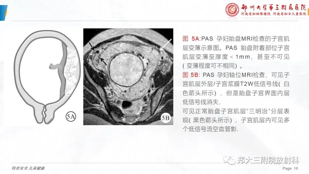 影像PPT - 要点解读-16