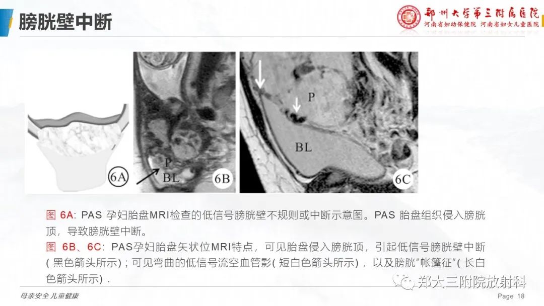 影像PPT - 要点解读-18