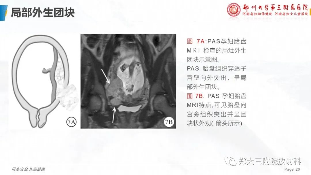 影像PPT - 要点解读-20