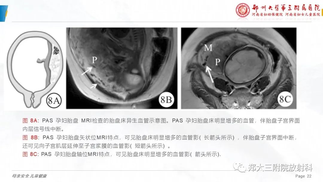影像PPT - 要点解读-22