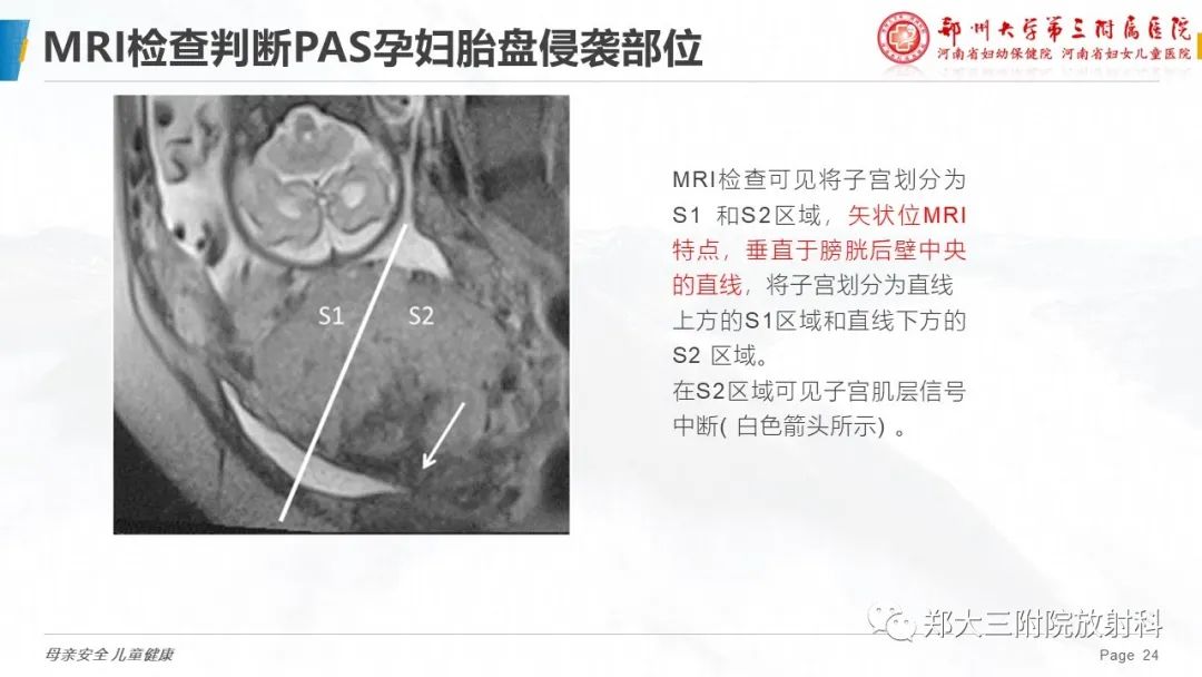影像PPT - 要点解读-24