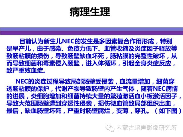 影像PPT - 【PPT】坏死性小肠结肠炎-3