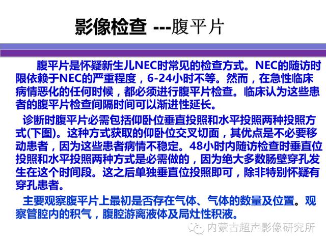 影像PPT - 【PPT】坏死性小肠结肠炎-6