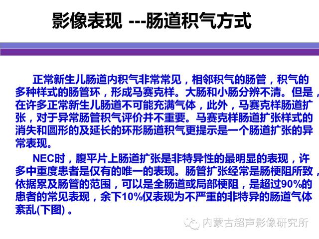 影像PPT - 【PPT】坏死性小肠结肠炎-10