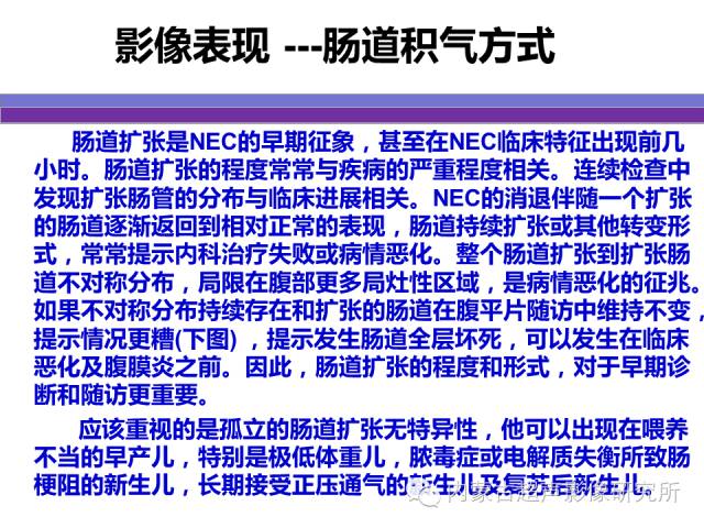 影像PPT - 【PPT】坏死性小肠结肠炎-12